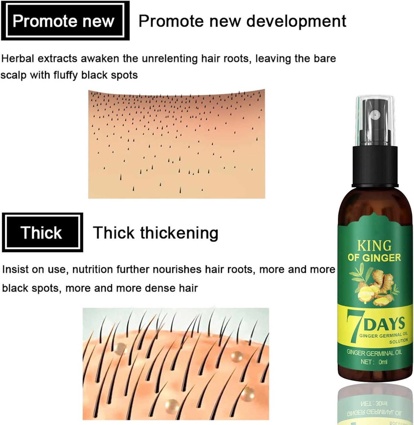 SPRAY DE JENGIBRE EELHOE – HIDRATA, ESTIMULA EL CRECIMIENTO Y PREVIENE LA CAÍDA DEL CABELLO