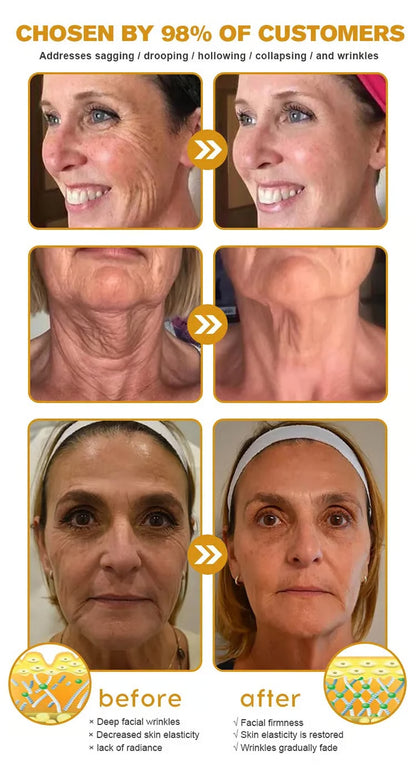 BEE VENOM - EL ELIXIR REJUVENECEDOR PARA LA PIEL DE 50+