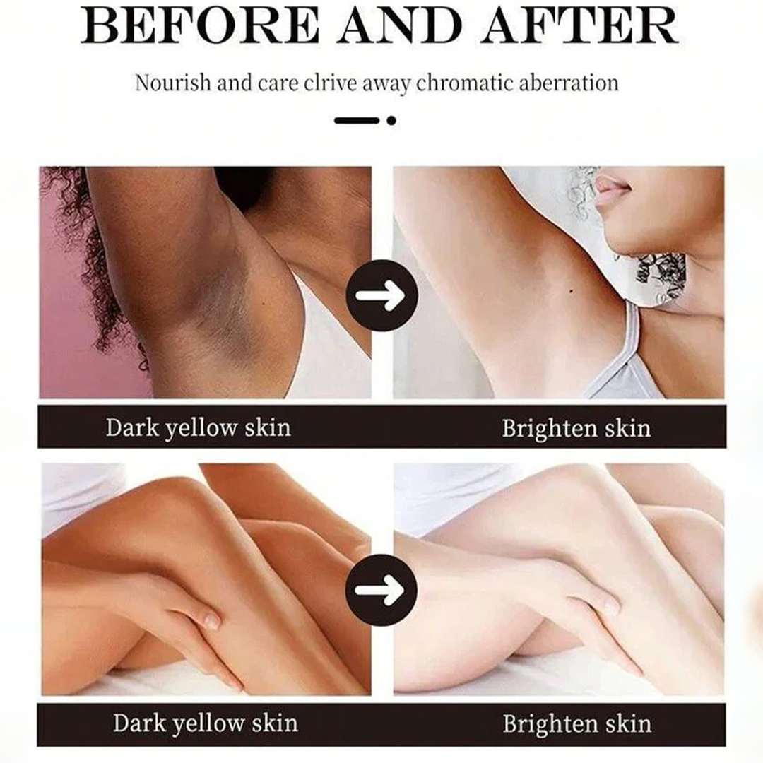 CREMA ANTI MANCHAS MAYCHEER – PARA MUJERES DE 45 A 55 AÑOS