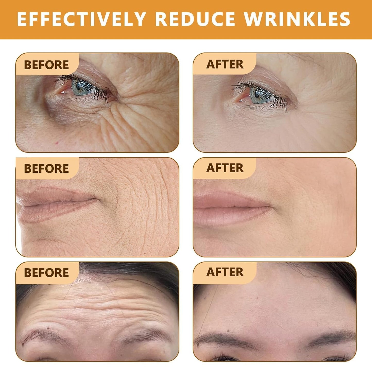 BEE VENOM - EL ELIXIR REJUVENECEDOR PARA LA PIEL DE 50+