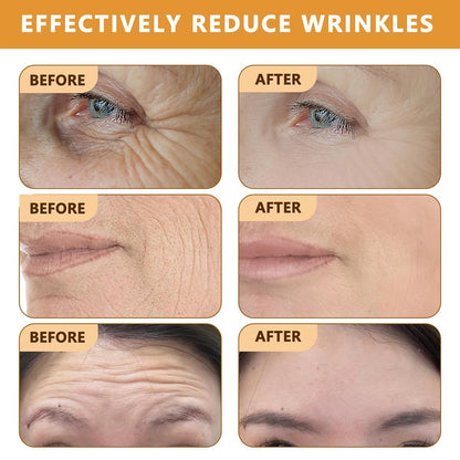 BEE VENOM - EL ELIXIR REJUVENECEDOR PARA LA PIEL DE 50+