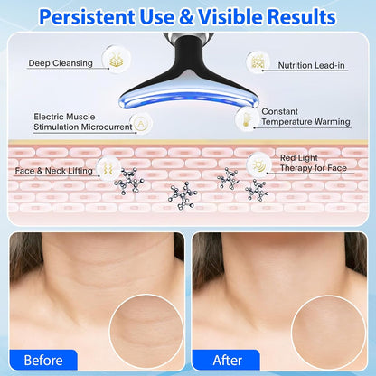 LUMINA REBORN RENACE TU PIEL CON LA NUEVA LUZ ROJA