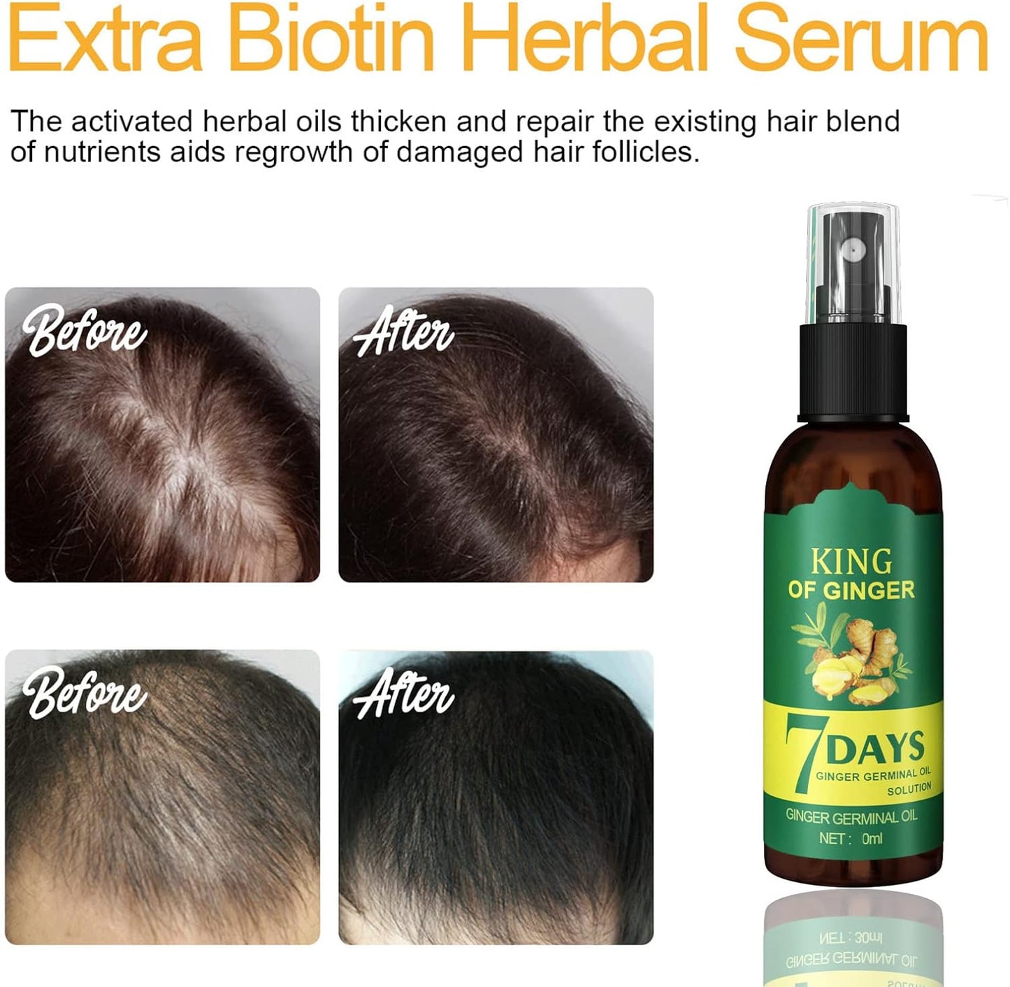 SPRAY DE JENGIBRE EELHOE – HIDRATA, ESTIMULA EL CRECIMIENTO Y PREVIENE LA CAÍDA DEL CABELLO